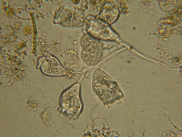 Belebtschlamm unter dem Mikroskop
