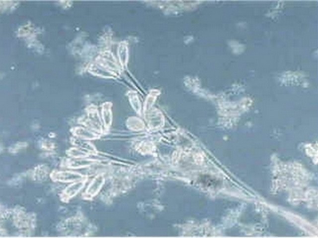Mikroskop Wimpertierchen